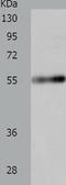Solute Carrier Family 18 Member A2 antibody, TA321553, Origene, Western Blot image 