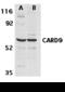 Caspase Recruitment Domain Family Member 9 antibody, 11003, QED Bioscience, Western Blot image 