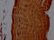 Actinin Alpha 2 antibody, CSB-PA001242LA01HU, Cusabio, Immunohistochemistry paraffin image 