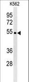 WD Repeat Domain 73 antibody, LS-C160601, Lifespan Biosciences, Western Blot image 