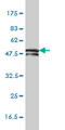 Keratin 81 antibody, LS-B4365, Lifespan Biosciences, Western Blot image 