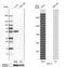 Keratin 13 antibody, NBP2-38166, Novus Biologicals, Western Blot image 