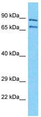 NBPF Member 11 antibody, TA337460, Origene, Western Blot image 