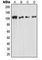 Nuclear Factor Kappa B Subunit 1 antibody, MBS822156, MyBioSource, Western Blot image 