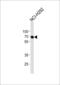 Matrix Metallopeptidase 14 antibody, 62-171, ProSci, Western Blot image 