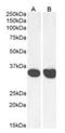 Malate Dehydrogenase 2 antibody, orb389374, Biorbyt, Western Blot image 