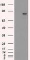 SATB Homeobox 1 antibody, GTX83684, GeneTex, Western Blot image 