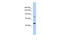 MAX Dimerization Protein MGA antibody, ARP47556_P050, Aviva Systems Biology, Western Blot image 