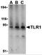 Toll Like Receptor 1 antibody, 3639, ProSci, Western Blot image 