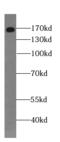 Gem Nuclear Organelle Associated Protein 5 antibody, FNab03420, FineTest, Western Blot image 