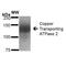 ATPase Copper Transporting Beta antibody, MA5-27719, Invitrogen Antibodies, Western Blot image 