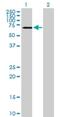 CaM Kinase Like Vesicle Associated antibody, H00079012-B01P, Novus Biologicals, Western Blot image 