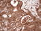 Fascin Actin-Bundling Protein 1 antibody, LS-C340659, Lifespan Biosciences, Immunohistochemistry frozen image 