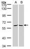 MAGUK p55 subfamily member 3 antibody, GTX102685, GeneTex, Western Blot image 