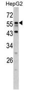 Downstream Neighbor Of SON antibody, AP17291PU-N, Origene, Western Blot image 