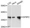 Insulin Like Growth Factor Binding Protein 2 antibody, MBS125640, MyBioSource, Western Blot image 