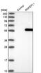 Arginyl Aminopeptidase Like 1 antibody, PA5-57808, Invitrogen Antibodies, Western Blot image 
