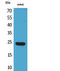 Interferon Epsilon antibody, STJ96669, St John