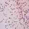 Granulysin antibody, orb13434, Biorbyt, Immunohistochemistry paraffin image 