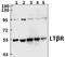 Lymphotoxin Beta Receptor antibody, PA5-75283, Invitrogen Antibodies, Western Blot image 