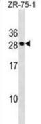 C-Type Lectin Domain Containing 9A antibody, abx029711, Abbexa, Western Blot image 