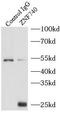 Zinc Finger Protein 740 antibody, FNab09735, FineTest, Immunoprecipitation image 