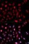 ASH2 Like, Histone Lysine Methyltransferase Complex Subunit antibody, LS-C334035, Lifespan Biosciences, Immunofluorescence image 