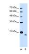 Transmembrane Protein 91 antibody, NBP1-70730, Novus Biologicals, Western Blot image 