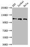 RAB3 GTPase Activating Protein Catalytic Subunit 1 antibody, CSB-PA621861LA01HU, Cusabio, Western Blot image 