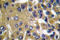 Matrix Metallopeptidase 13 antibody, LS-C176122, Lifespan Biosciences, Immunohistochemistry frozen image 