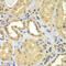 Cytosolic Iron-Sulfur Assembly Component 1 antibody, 22-888, ProSci, Immunohistochemistry paraffin image 