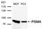Folate Hydrolase 1 antibody, A02846, Boster Biological Technology, Western Blot image 