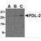 Programmed Cell Death 1 Ligand 2 antibody, MBS151188, MyBioSource, Western Blot image 