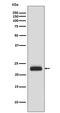 CASP2 And RIPK1 Domain Containing Adaptor With Death Domain antibody, M06509-1, Boster Biological Technology, Western Blot image 
