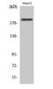 Insulin Receptor Substrate 1 antibody, A00268S1101-1, Boster Biological Technology, Western Blot image 