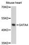 GATA Binding Protein 4 antibody, LS-C748787, Lifespan Biosciences, Western Blot image 