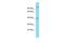 Nudix Hydrolase 19 antibody, PA5-46394, Invitrogen Antibodies, Western Blot image 