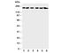 ALK Receptor Tyrosine Kinase antibody, R30831, NSJ Bioreagents, Western Blot image 