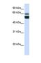 Sphingomyelin Phosphodiesterase 1 antibody, NBP1-69267, Novus Biologicals, Western Blot image 