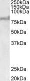 ATP Binding Cassette Subfamily D Member 2 antibody, NBP2-26123, Novus Biologicals, Western Blot image 