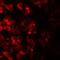 Transmembrane protein 106B antibody, NBP2-82027, Novus Biologicals, Immunocytochemistry image 