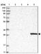 CTD Nuclear Envelope Phosphatase 1 antibody, NBP1-87961, Novus Biologicals, Western Blot image 
