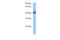 RNA Binding Motif Protein 4 antibody, 29-298, ProSci, Western Blot image 