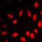 Vitamin D Receptor antibody, LS-C352989, Lifespan Biosciences, Immunofluorescence image 