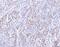 C-C Motif Chemokine Receptor 7 antibody, A00390-2, Boster Biological Technology, Immunohistochemistry paraffin image 