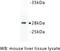 Tyrosine 3-Monooxygenase/Tryptophan 5-Monooxygenase Activation Protein Beta antibody, MBS355189, MyBioSource, Western Blot image 