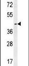 Lysosomal Protein Transmembrane 5 antibody, PA5-23585, Invitrogen Antibodies, Western Blot image 