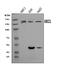 ATP Binding Cassette Subfamily C Member 1 antibody, A00872-1, Boster Biological Technology, Western Blot image 