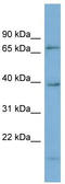 Heterochromatin Protein 1 Binding Protein 3 antibody, TA345041, Origene, Western Blot image 