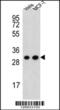 Cytochrome C1 antibody, 61-888, ProSci, Western Blot image 
